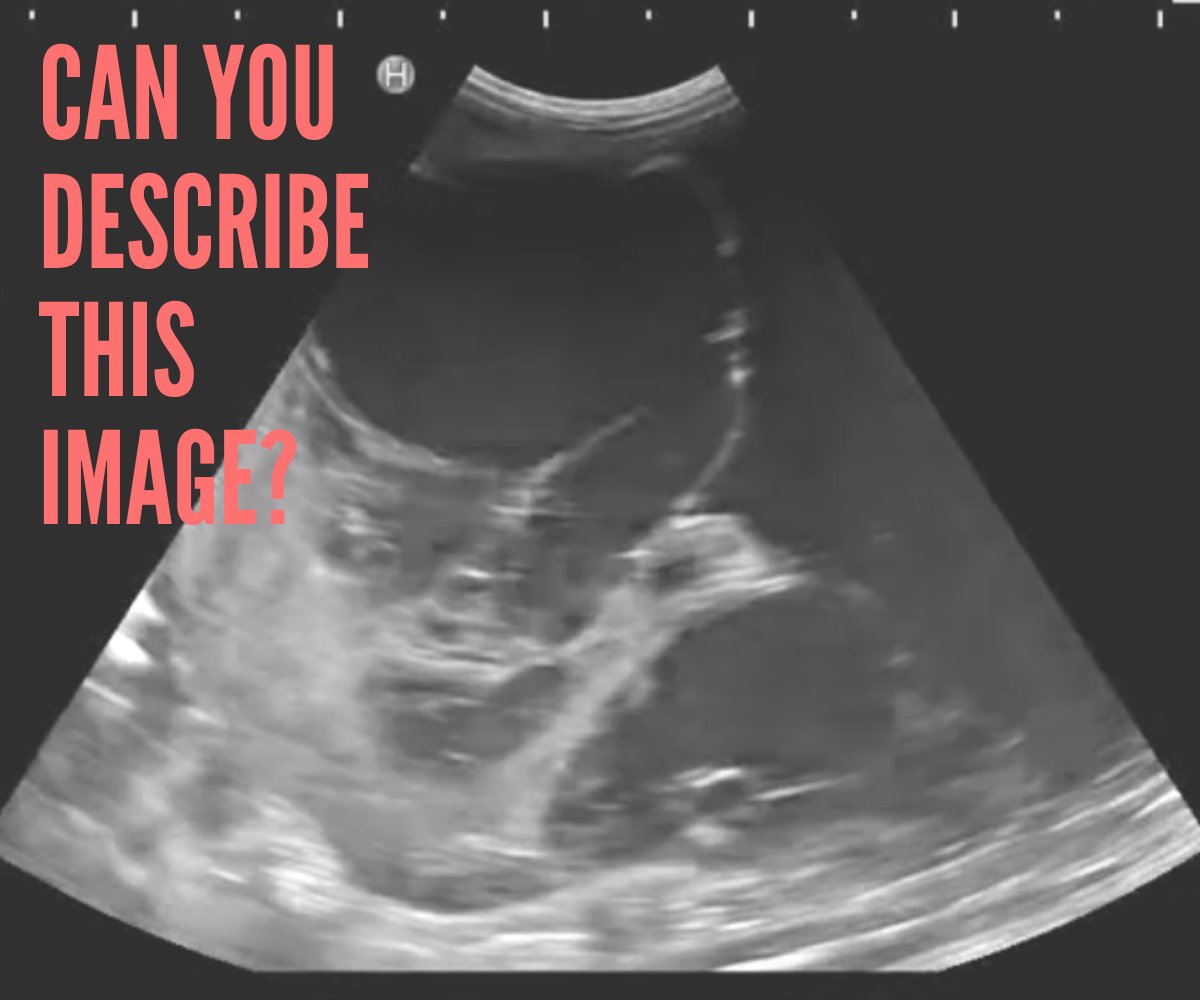 VetScanSchool's tweet photo. How do you read images quickly with confidence? 
Know the tricks!  Some DVM's have seen different tricks that help them get the window they need, or they follow the anatomy.  Some tricks help you get better faster, but YOU NEED A COACH!   Start your journey today - Scan School https://t.co/3r0F8KyWcE