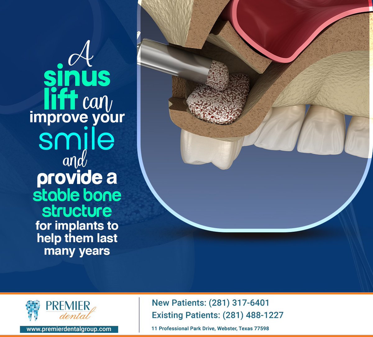 PremierDentalCL's tweet image. Sinus augmentation, also known as sinus lift surgery, raises the sinus floor and allows new bone to develop to provide a stable foundation for dental implants. Learn more at premierdentalgroup.com #sinusaugmentation #premierdental #mauriciorodriguezdds #webster #TX