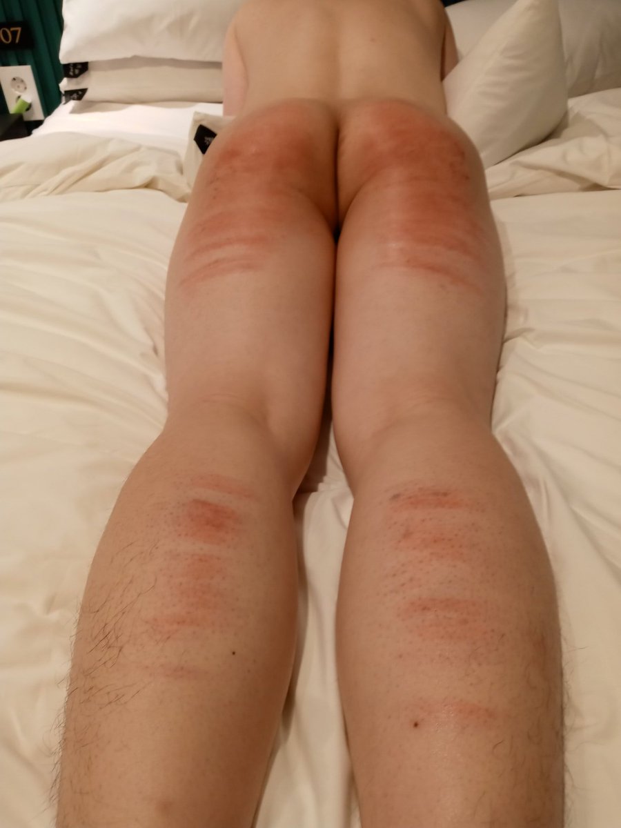 MSspankee031's tweet photo. 시작할때 맞고 벌서면서 맞고 쉴때도 맞고 오컨할때고 맞고 계속해서 맞은날 
빠른 회복력 덕분에 일주일만에 90%나은듯 또 맞고 싶다

#스팽 #멜섭 #펨돔 #멜키 #펨커 https://t.co/C7HKLatPkp