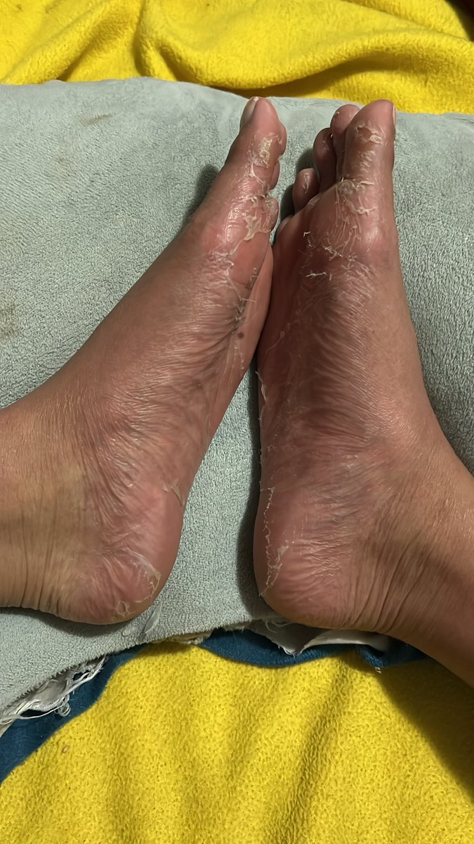 GoddessRaven15's tweet photo. The peeling has began. What foot boi is gonna buy my peelings!! 

Findom Ebonydomme EbonyGoddess Paypig Finsub HumanATM WalletDrain Foot Footworship Footfetish @rt_feet @ebonypromo https://t.co/xMWRMt0ppt