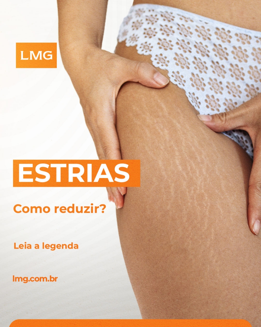 _wmbmarketing's tweet photo. Pesadelo de muitas pessoas, as estrias aparecem em nosso corpo com muito mais facilidade do que saem.
Post completo em: https://t.co/Ne44czf4wx
#Eletroderme #ProCollagen #LMGLasers #PlataformaSolon #Tecnologia #Estrias https://t.co/mEq18yWWH4
