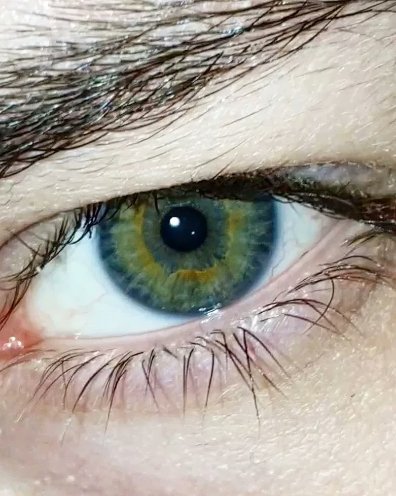 FukurouSan__'s tweet photo. I hate every inch of my body. Except for my eyes, I guess they can stay.
#CentralHeterochromia #Distichiasis https://t.co/nhCrYXY2V5