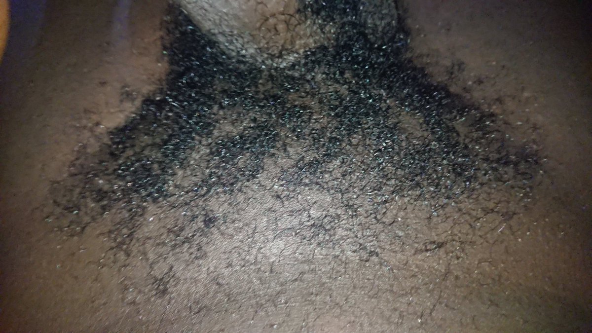 CMuzzinyi's tweet photo. Too hairy..!! 
I need a lady to shave and massage it. 
Ladies DM https://t.co/ZxLo95hrIk