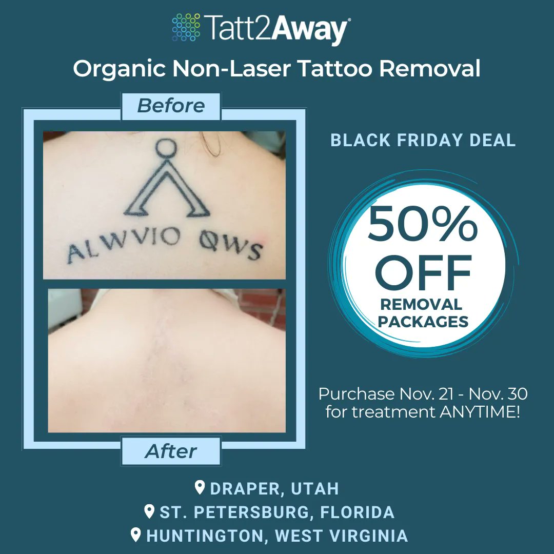 Tatt2Away's tweet photo. 🖤 BLACK FRIDAY came early this year!!🖤 Purchase a package between Nov. 21st-Nov. 30th &amp; get 50% off when paid in full. Book now in our Draper, Huntington, or St. Petersburg locations and get treated any time. Remove your tattoo with Tatt2Away: Organic, non-laser tattoo removal! https://t.co/Et3GZoV00O