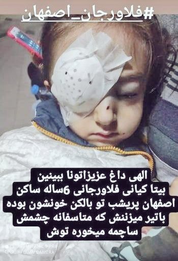 بیتای ۶ساله تا آخر عمرش دنیا رو با یک چشم می‌بینه. به پدر و مادرش گفتن بچه‌ت نباید توی بالکن بازی میکرد.
#مهسا_امینی
