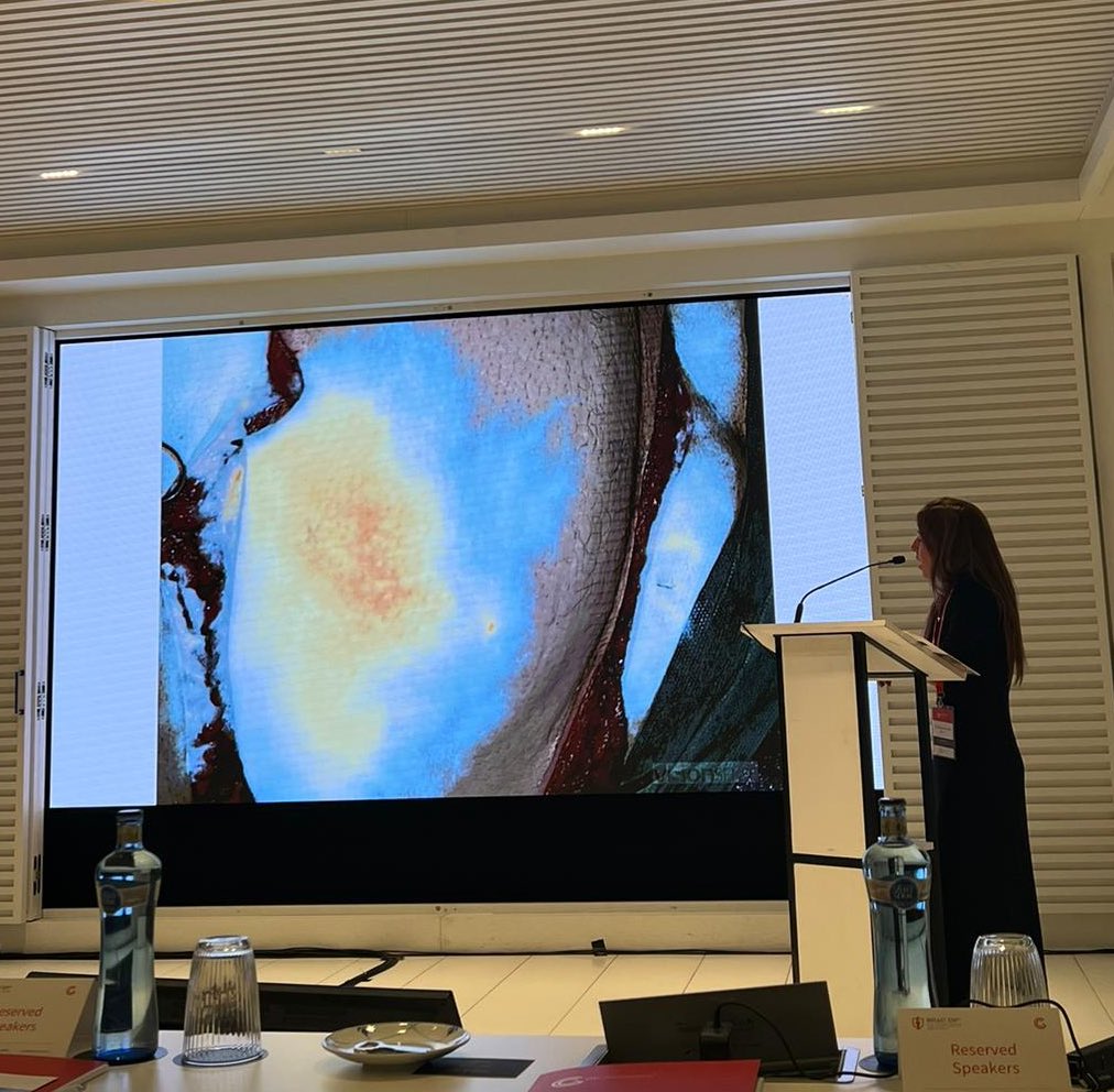 mireiaruizcast1's tweet photo. Me llevo muchas cosas del “Expert Forum in Breast Reconstruction” y unas ganas locas de trabajar con #FixNip en reconstrucción del complejo areola pezón. #reconstruccion_mama #innovacion #pacientes 
#GCAacademy #cirugiaplastica @RuizCastilla @QS_Barcelona @QS_Dexeus @quironsalud https://t.co/y3F6h4KnK5