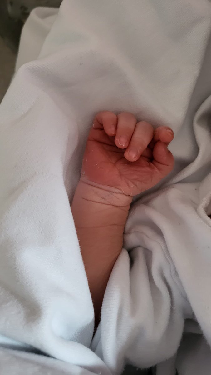 Por fin Kore está con nosotros. Ayer me llamaron para repetir doppler en el hospital por precaución y allí me quedé ya ingresada para “inducción ya!”. Muchos nervios pero al final un parto rapidísimo e intenso, en el que no dio tiempo ni de epidural ni al padre a llegar 😅