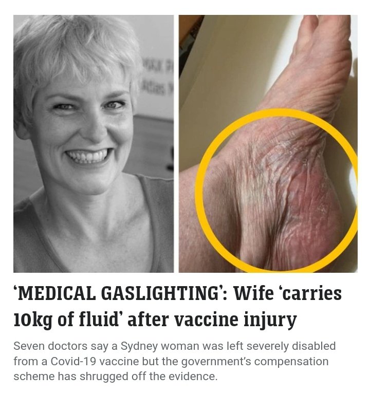 veritas__vox's tweet image. Aus 🇦🇺 The Gaslighting Continues 🔥 7 Doctors state this ladies sickness and subsequent injuries are from The Wax 🕯️....Yet she's been denied her claim from the Govt WAX Compensation Scheme..