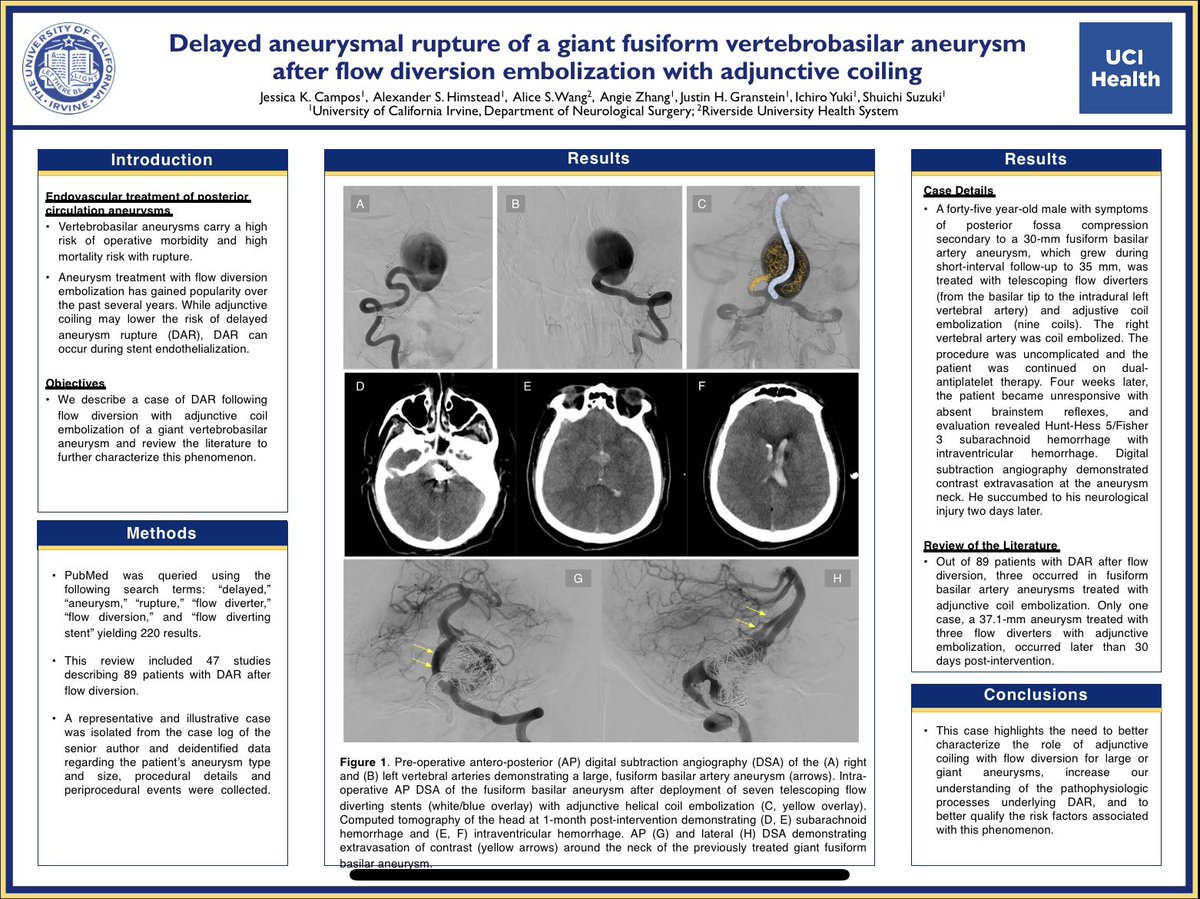 Excited our <a href="/UCINeurosurgery/">UC Irvine Neurosurgery</a> NeuroIR fellow, Dr. Granstein <a href="/jgranstein/">jgransteinMD</a>, presented our work with Dr. Suzuki at this year’s <a href="/svinsociety/">SVIN</a> meeting. #neurointervention #endovascularneurosurgery #BrainAneurysm #SVIN202