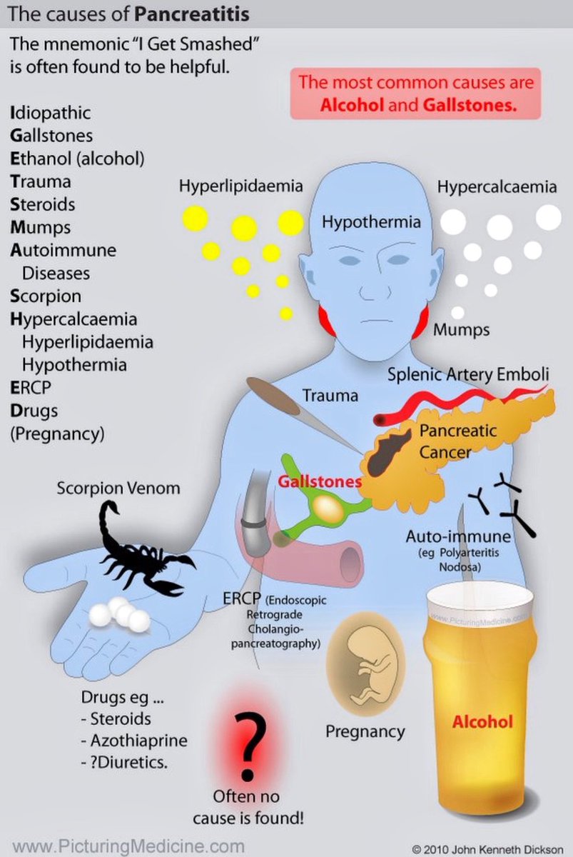 Pancreatitis causes #MedEd #Pancreatitis #FOAMed #MedTwitter #MedStudentTwitter #NurseTwitter #Medical #health #science