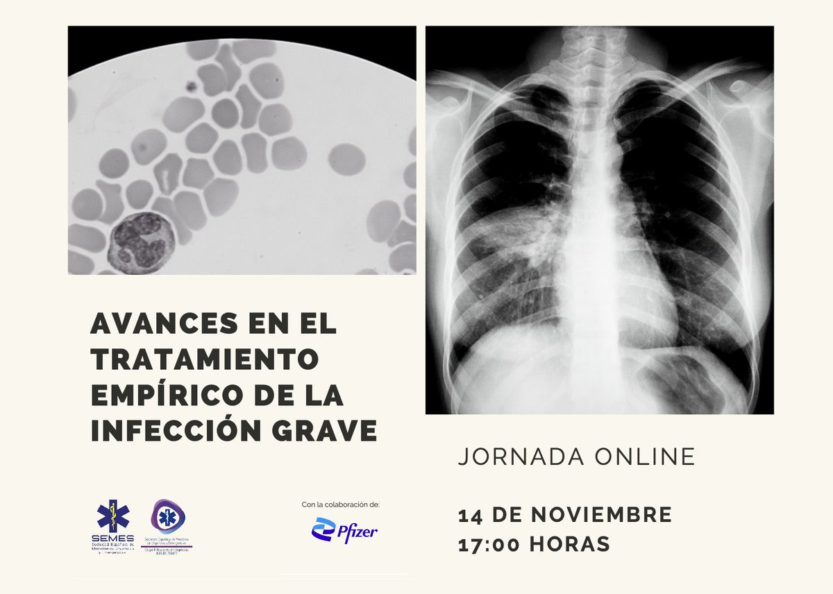 pfizer_spain's tweet photo. 👨🏻💻 🦠 Invitamos a profesionales sanitarios a esta jornada online que organizan @SEMES_ e @infurgsemes sobre el tratamiento empírico de la infección grave #PfizerPro
🗓️ Lunes 14 de noviembre
🕢 17:00h
👉🏻 https://t.co/TQqb8Lm9QH https://t.co/w9JRRp9HKU
