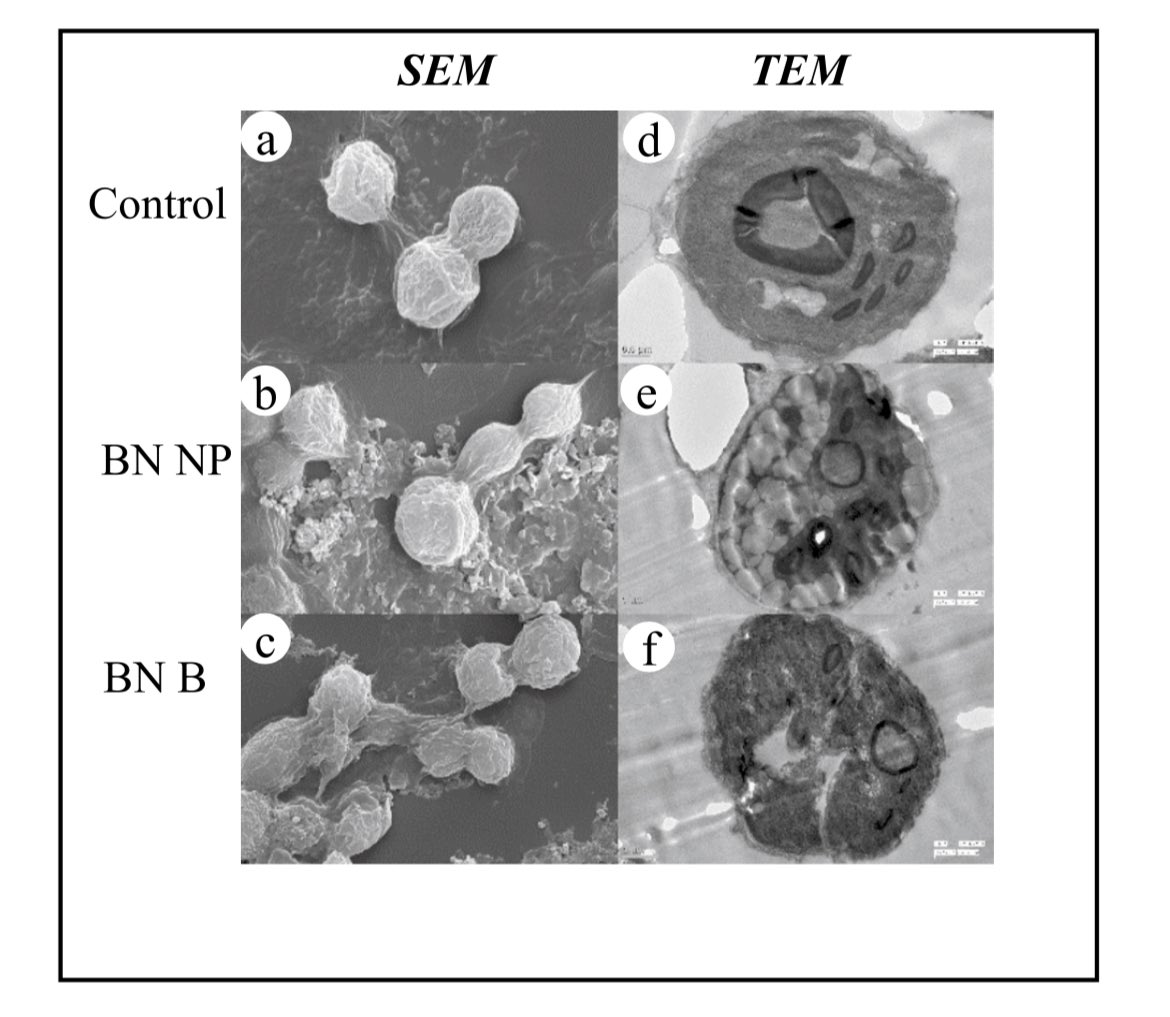 #nanotoxicity  Impact of #nanomaterials on #aquatic #organism <a href="/DBTIndia/">Department of Biotechnology</a> <a href="/BIRAC_2012/">DBT-BIRAC</a> <a href="/IndiaDST/">DSTIndia</a> <a href="/iiscbangalore/">IISc Bangalore</a> <a href="/teriin/">TERI</a> <a href="/NatureNano/">Nature Nanotechnology</a> <a href="/Nanowerk/">Nanowerk</a> <a href="/icarindia/">Indian Council of Agricultural Research.</a> <a href="/MpuatUdaipur/">MPUAT Udaipur</a> #enviorment                                                doi.org/10.1007/s11356…