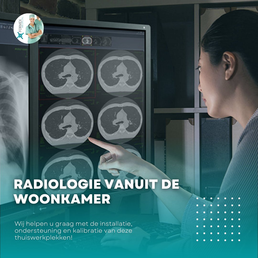 FormexMedical's tweet image. Voor radiologen heeft thuiswerken vooral voordelen maar voor beheerders is het een uitdaging. Wij helpen met het installeren, ondersteunen en kalibreren van dit soort thuiswerkplekken! #radiologie #thuiswerken