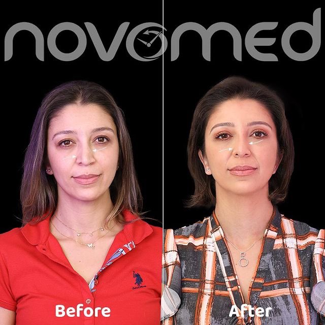 Novomed tweet media