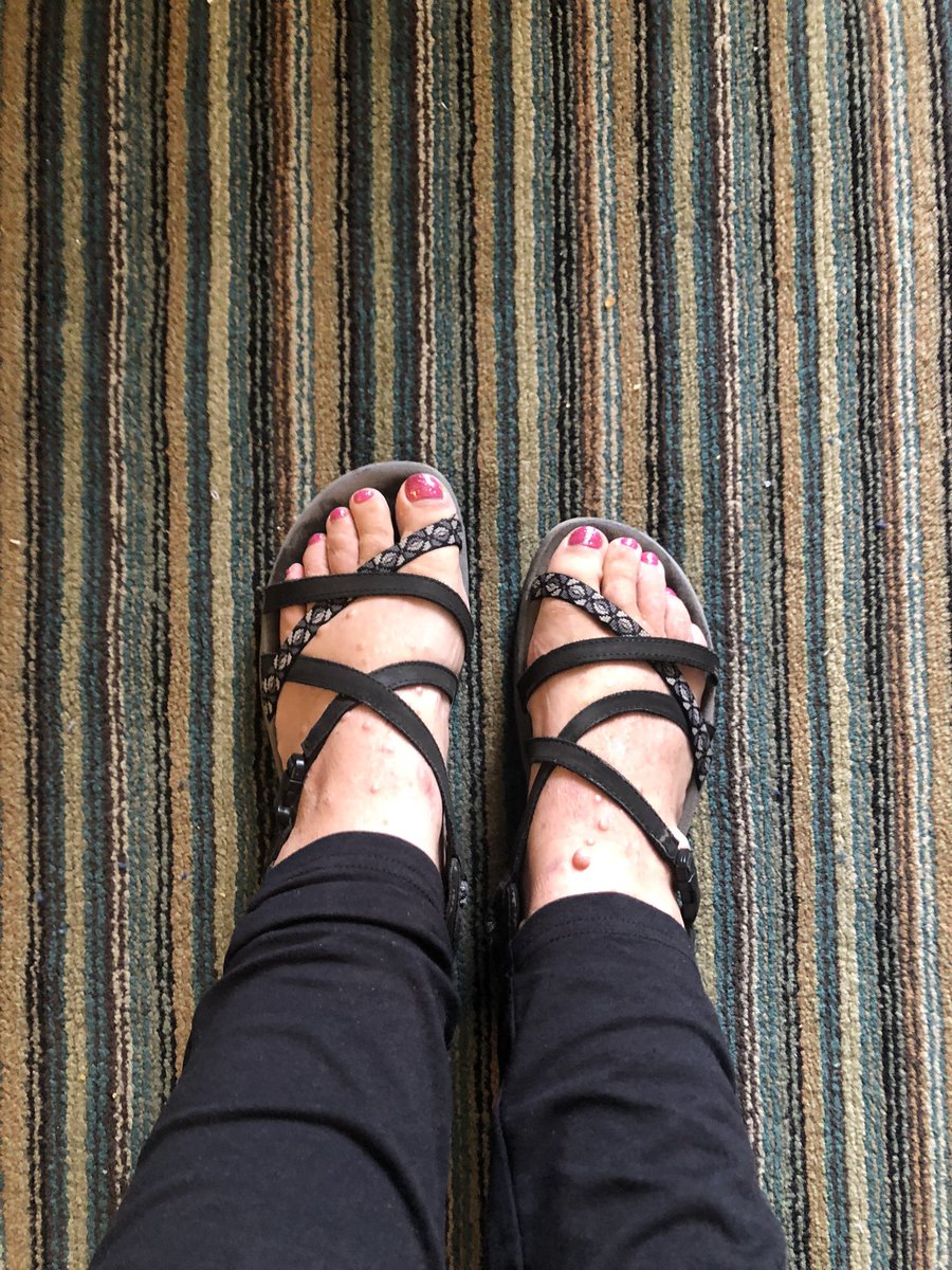 GSDmomma1997's tweet image. @Macys what happens when you buy the perfect size 9 shoes for a destination wedding only to get to said wedding and have one shoe be size 9 and the other a size 6? Rock your Sketchers! #shoeemergency #epicshoefail #macysfail #weddingdisaster #kennethcole #sketchers #rockedthepedi