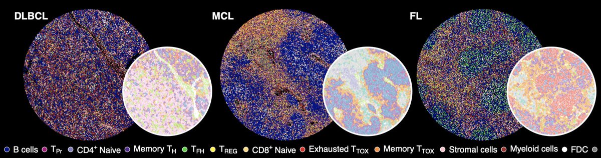 Our new preprint from <a href="/DietrichLab/">DietrichLab</a>, @wolfgangkhuber's and <a href="/GarryPNolan/">Garry P. Nolan</a>’s lab is online: The T cell landscape across nodal B cell #lymphoma defined by CITE-seq, scTCR-seq, FACS and CODEX: biorxiv.org/content/10.110…