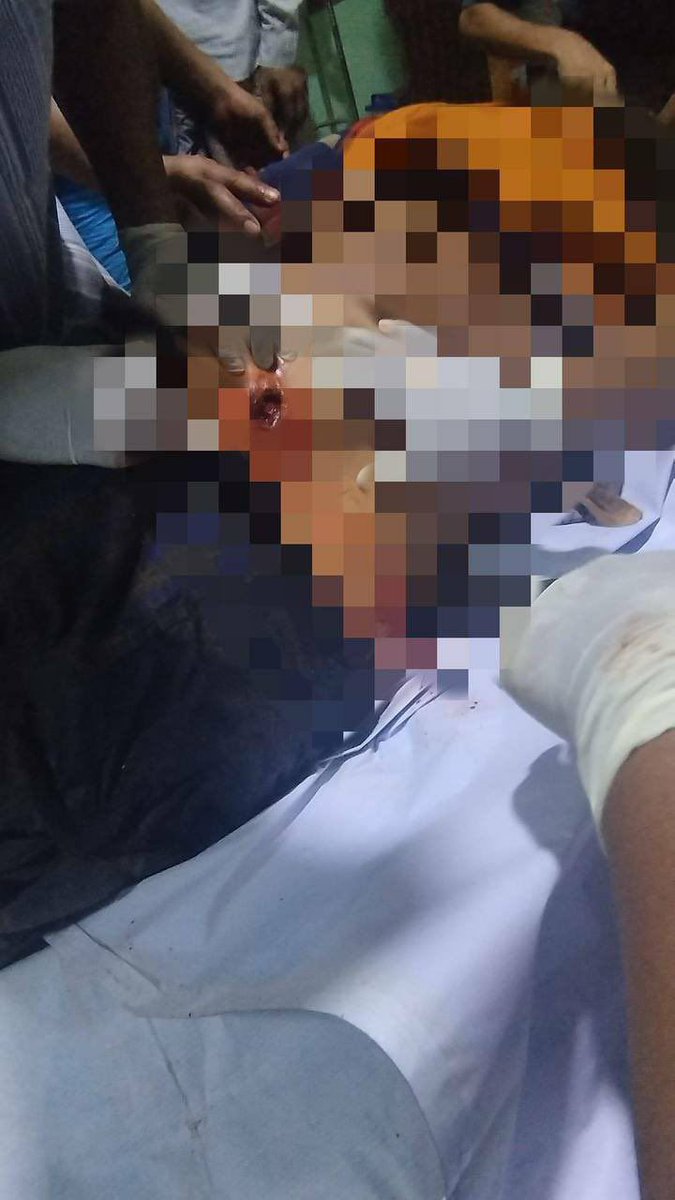 TTFR__Myanmar's tweet photo. Military troops arbitrarily shelled heavy weapons in Sheinmakar village, Wetlet tsp, Sagaing division on the full moon day of Tazaungdaung, resulting in death of a local woman and injuring of 3 including a child. #2022Nov8Coup  #CrimesAgainstHumanity  #WhatsHappeningInMyanmar https://t.co/ob4KwDBCzp