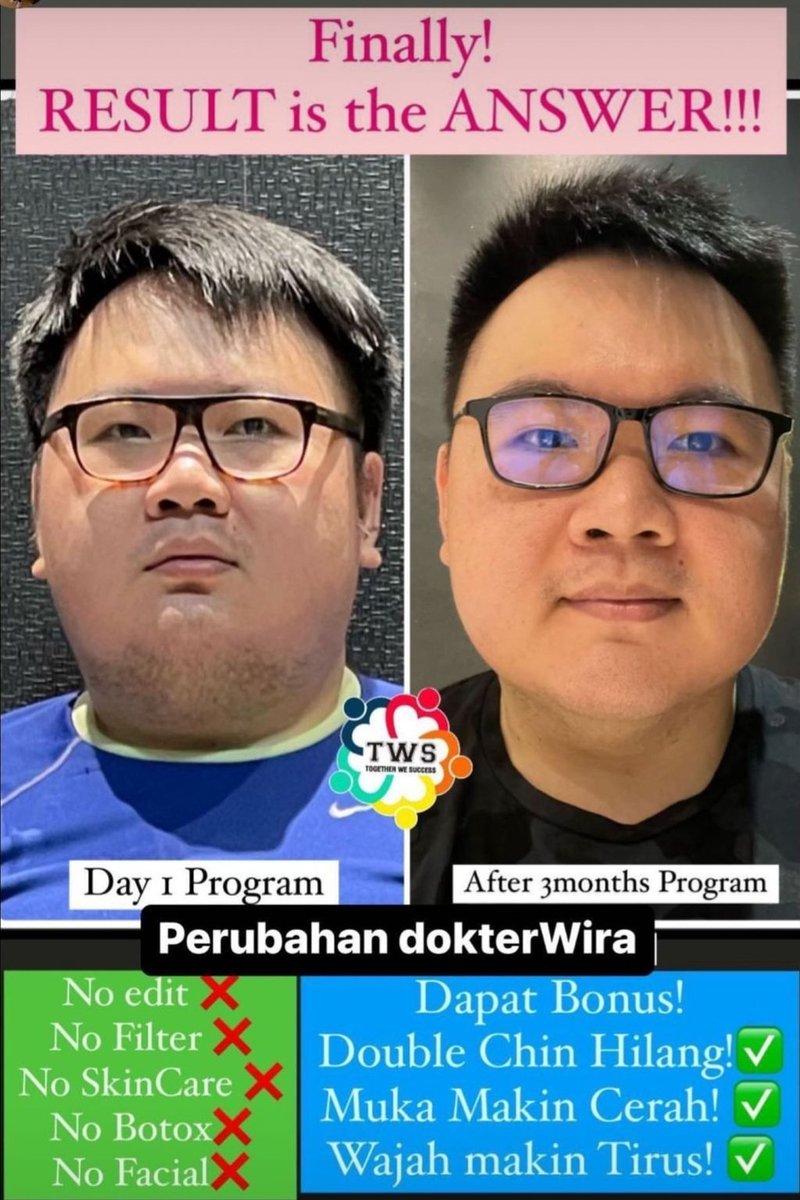 shelz_SB's tweet image. Yang masih kaum pantau, masih galau, tunggu nanti" dulu programnya.
Tinggal 2 bulan menuju tahun baru, masa body nya mau tetep segitu" aja?
New year, new body dong.🥰
#twsprogram #programtws #diet #dietsehat #newyear #bodygoals #healthylifestyle