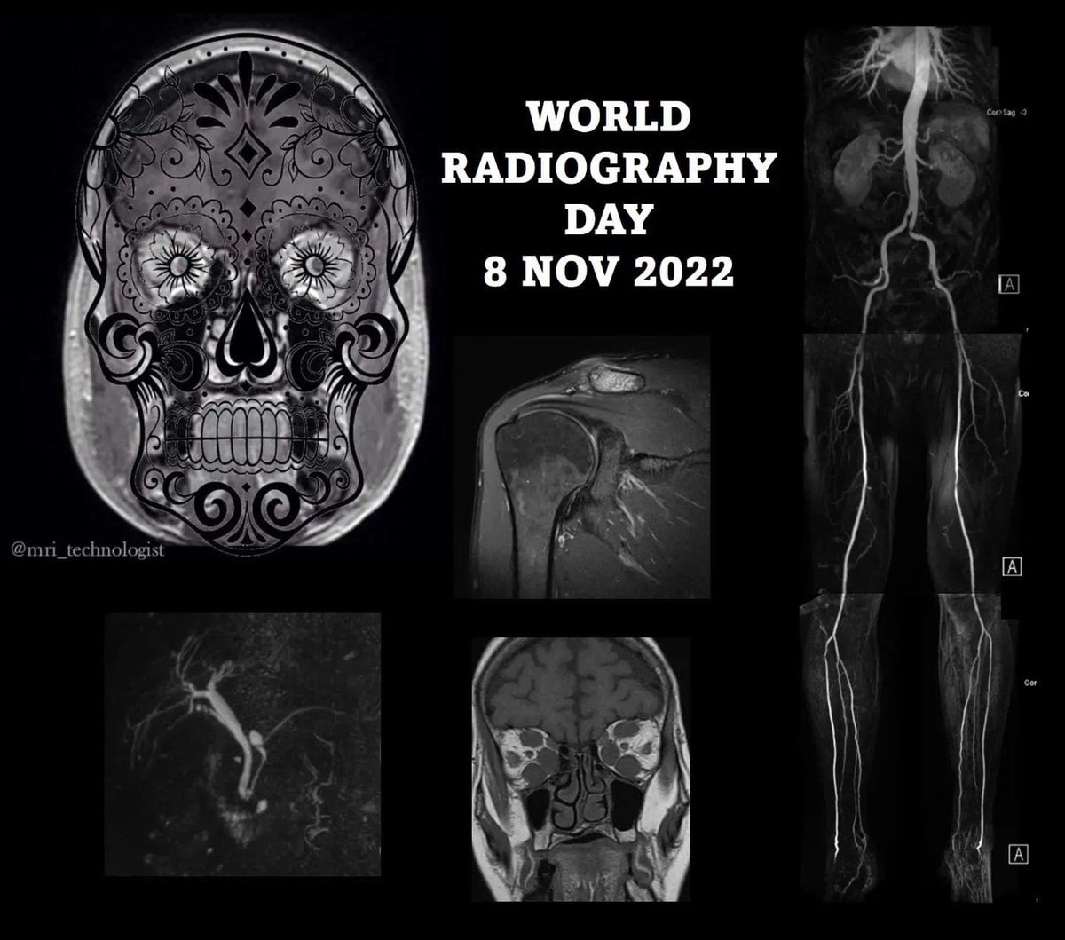 Happy world radiography day #scor #mri #RadiologyDay