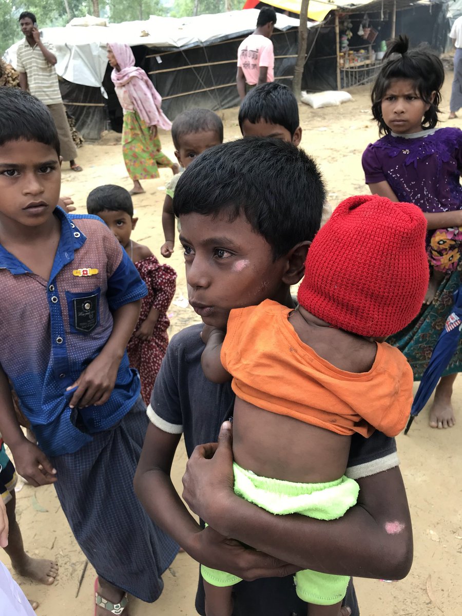 Dr.Fozia Alvi (@alvifozia) on Twitter photo We often say" where's the next Einstein? It can be one of these #Rohingya children, who're wasting their lives in the refugees camps, every child has a right to get #education this boy had multiple burns while escaping #Myanmar , <a href="/Refugees/">UNHCR, the UN Refugee Agency</a> We often say" where's the next Einstein? It can be one of these #Rohingya children, who're wasting their lives in the refugees camps, every child has a right to get #education this boy had multiple burns while escaping #Myanmar , <a href="/Refugees/">UNHCR, the UN Refugee Agency</a>