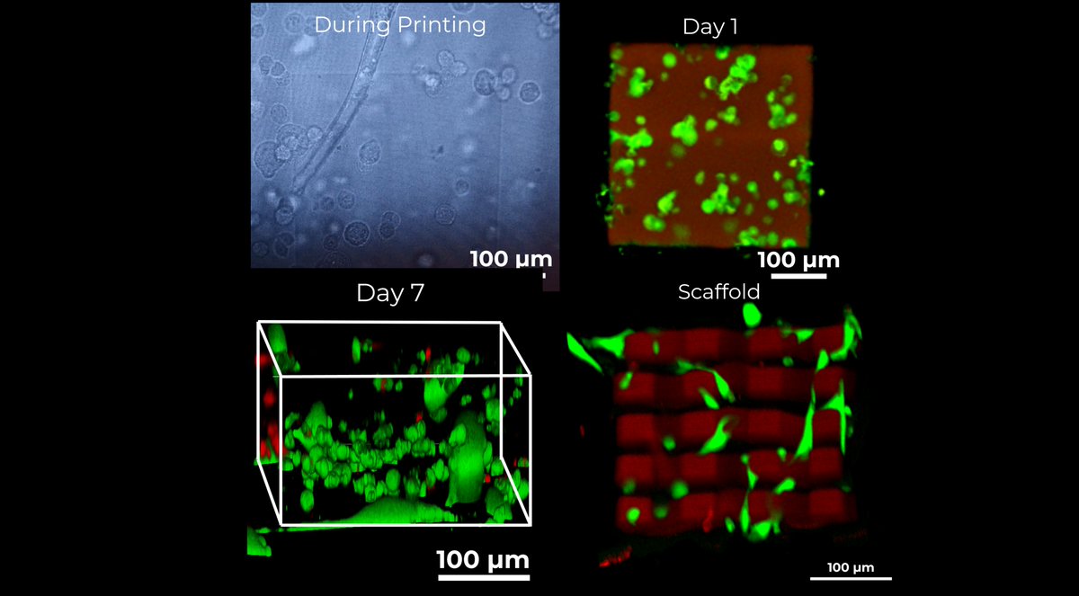 BIO_INX's tweet photo. !NEW PRODUCT LAUNCH!
@BIO_INX launches HYDROBIO INX N400, the first
@NanoscribeGmbH compatible resin enabling live cell printing down to the microscale!
Read all about this new breakthrough in our press release https://t.co/pIgizhszIn!
#bioinks #biofabrication #2PP #organonchip https://t.co/86Y8elSW92
