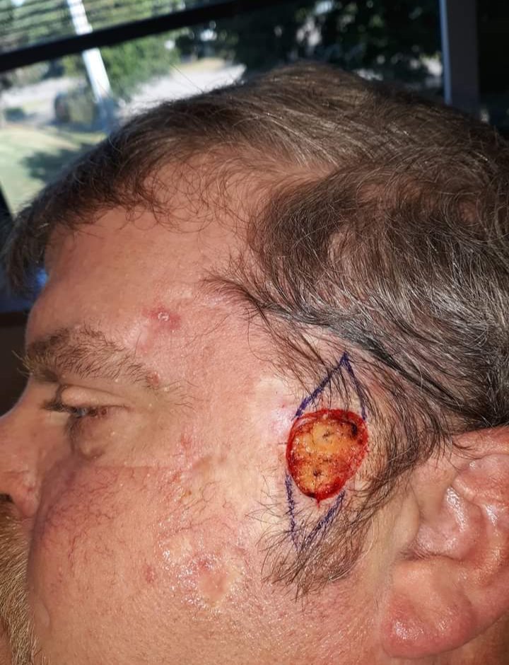 makeawishohio's tweet photo. Cancer sucks https://t.co/4e5LaOjrPo