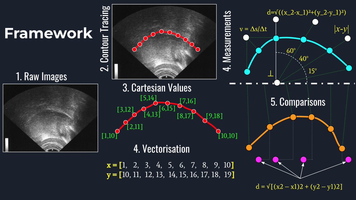 A big thank you to #Ultrafest X #Conference (ultrafestx.com) for the amazing opportunity to present a #masterclass on the #Shiny #App #Ultrasound #Visualization and #Analysis (github.com/simongonzalez/…). Great comments from the audience. Thank you! #Rstats #linguistics