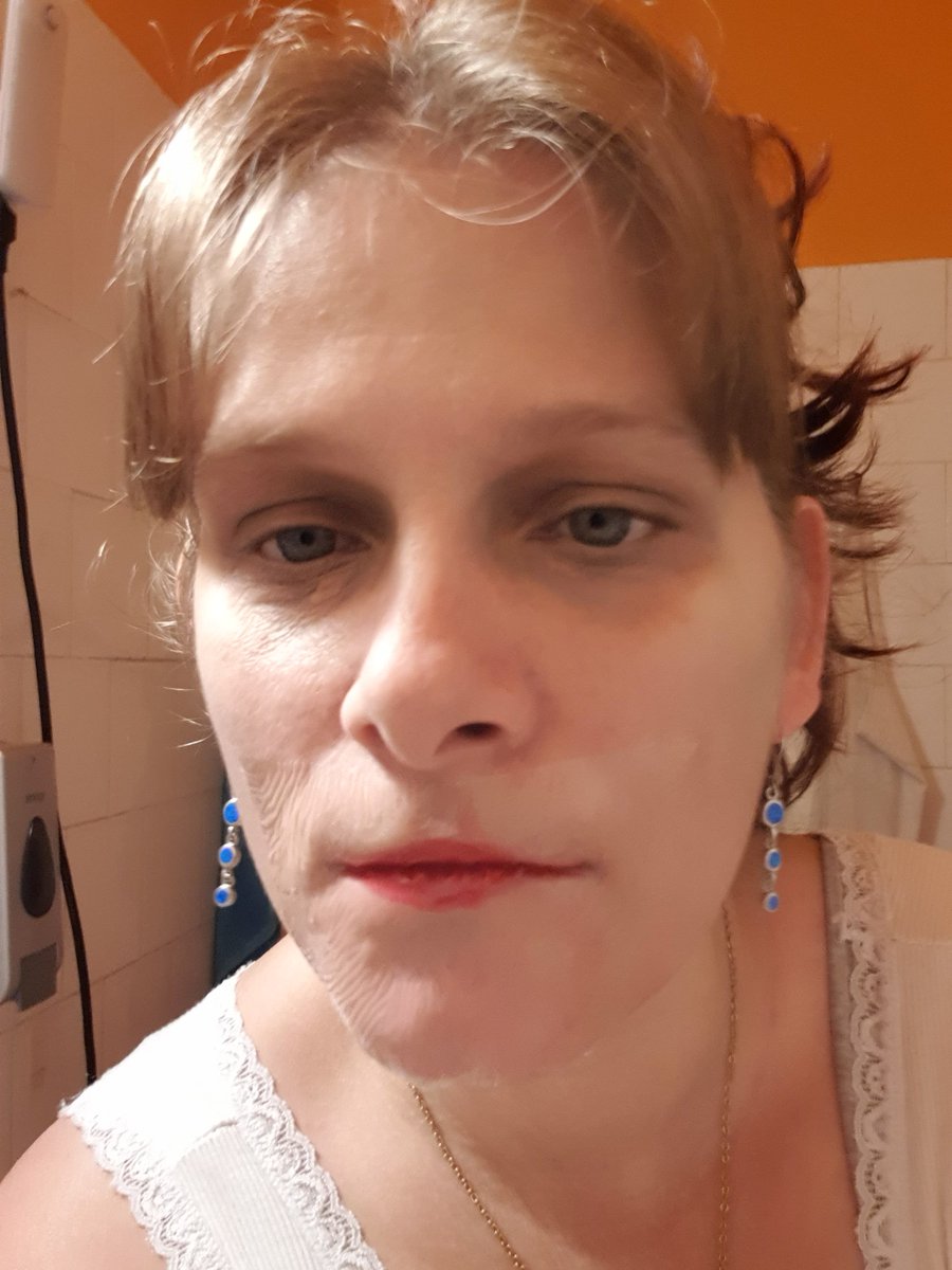 Photos and videos from my few mounts old quick set 😘
This is my favorite Tegaderm tape 😍 with red lipstick on 💄

More photo on OF for free 💲🆓