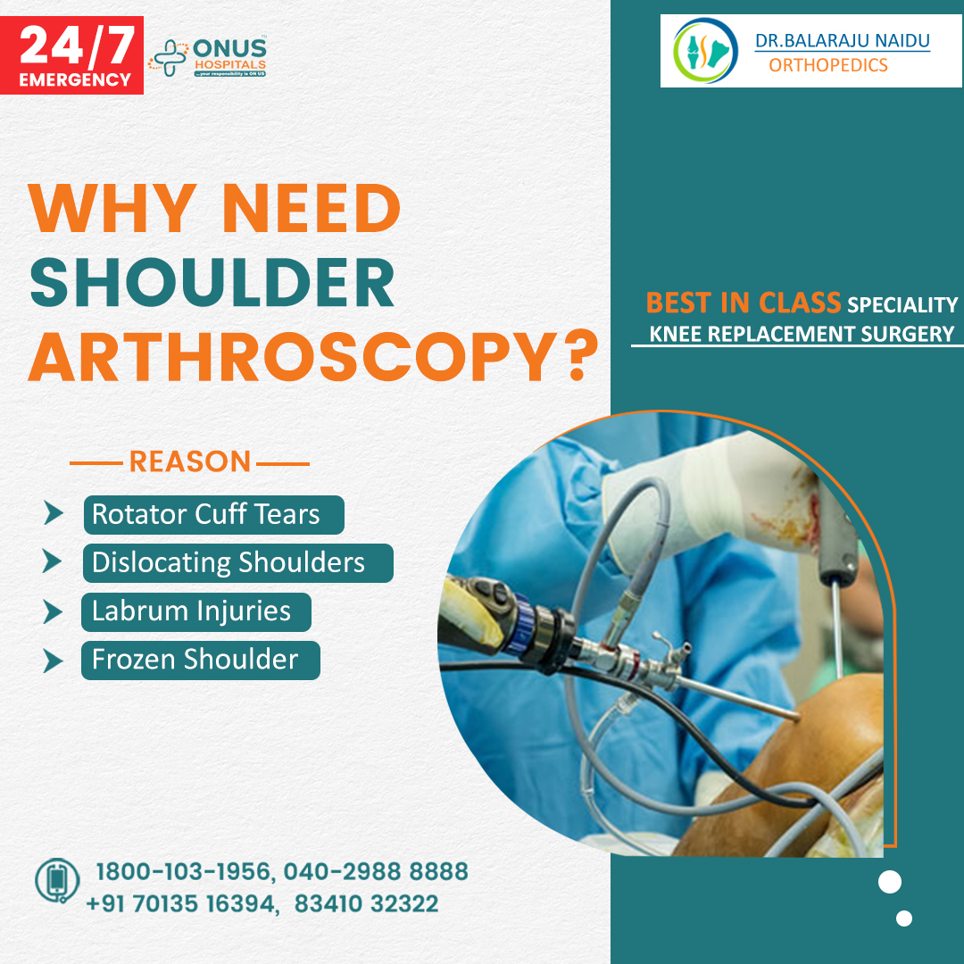 #Dr_Balarajunaidu  👨‍⚕️ | 𝗕𝗼𝗼𝗸 𝗔𝗽𝗽𝗼𝗶𝗻𝘁𝗺𝗲𝗻𝘁 | ☎ 1800-103-1956

Get to know Why is Shoulder Arthroscopy needed with orthopedic expert Dr.Balaraju gaaru  

#shoulderpain #orthopedicproblems #orthopedic
#JointReplacementSurgery #ReplacementSurgery #JointPain