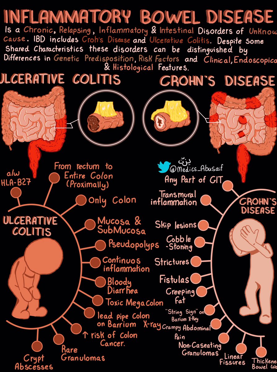 medics_AbuSaif's tweet photo. ملخصاتي عن مرض التهاب الأمعاء IBD يشمل UC &amp; Crohn’s وجميع الأعراض سواء intestinal &amp; extra-intestinal 📝 https://t.co/YewHVNW4Dn