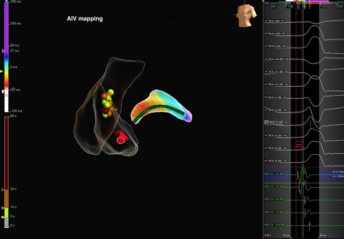 @ecgrhythms on Twitter: