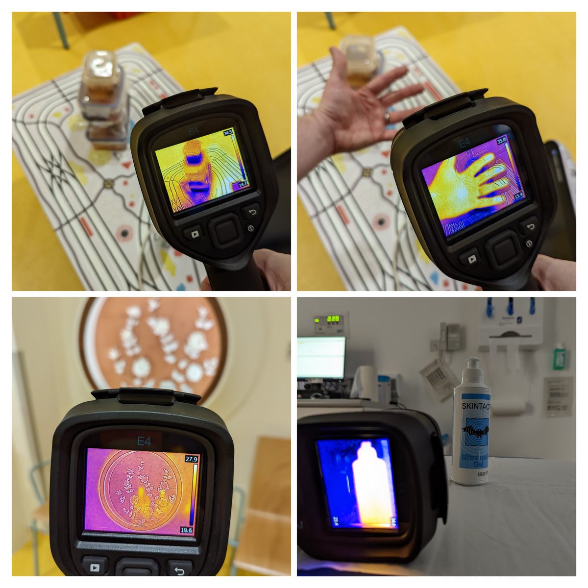 Thanks to <a href="/echcharity/">Edinburgh Children's Hospital Charity</a> lending theimaging dept a thermal camera to celebrate #IDOR22 #worldradiographyday2022. Turns out; ultrasound phantoms are cold, my hand is toasty, @kate_ive's art is beautiful beyond the visible spectrum and (despite what I get told) ultrasound gel is WARM!