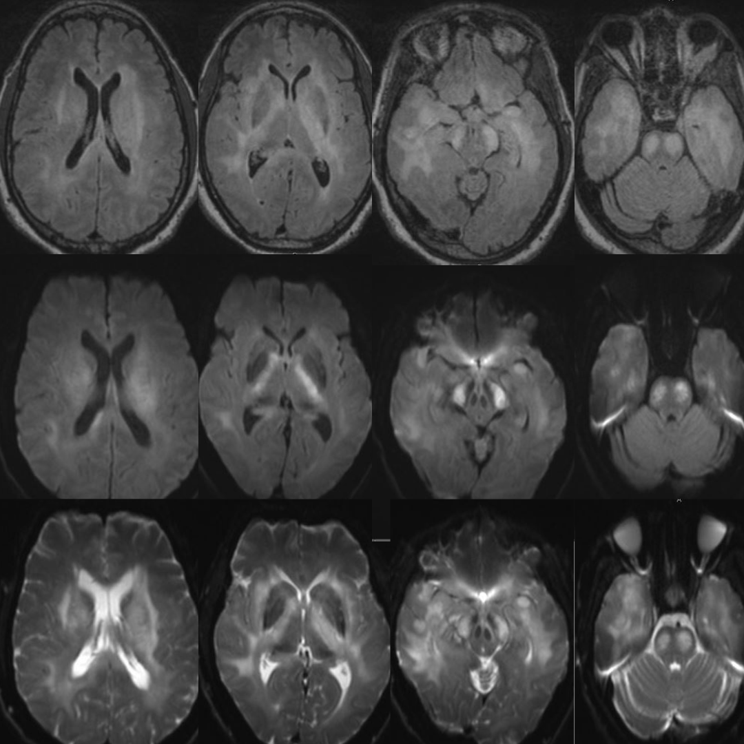 NeuroimagingN's tweet photo. https://t.co/GnfGAmYqus