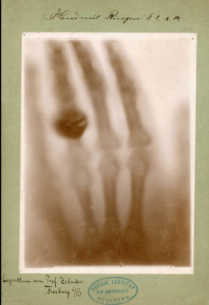 socidopra's tweet photo. El 8 de noviembre se celebra cada año el Día Internacional de la Radiología. La fecha conmemora el día en el que el Profesor Wilhem Conrad Röntgen descubrió, en 1895, los rayos X.
Fue el propio Röntgen el que hizo la primera radiografía a la mano de su mujer quien... https://t.co/V6zLAQ29rT