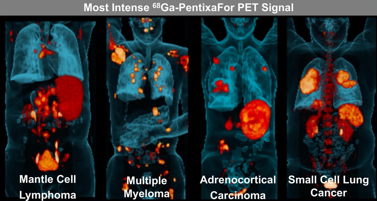 CXCR4 for targeted imaging…now on to CXCR4 targeted therapy? ow.ly/AkPb50LwM9m #MedicalImaging #PETScan #Cancer