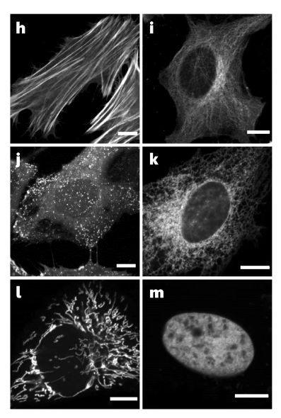 Nature Methods (@naturemethods) on Twitter photo Hyperfolder YFP (hfYFP) and its variants are remarkably stable, withstanding chaotropic conditions that denature other fluorescent proteins. They are well-suited for use in expansion microscopy and CLEM. <a href="/lysergicdesigns/">Ben Campbell</a>
OA paper: nature.com/articles/s4159… Hyperfolder YFP (hfYFP) and its variants are remarkably stable, withstanding chaotropic conditions that denature other fluorescent proteins. They are well-suited for use in expansion microscopy and CLEM. <a href="/lysergicdesigns/">Ben Campbell</a>
OA paper: nature.com/articles/s4159…