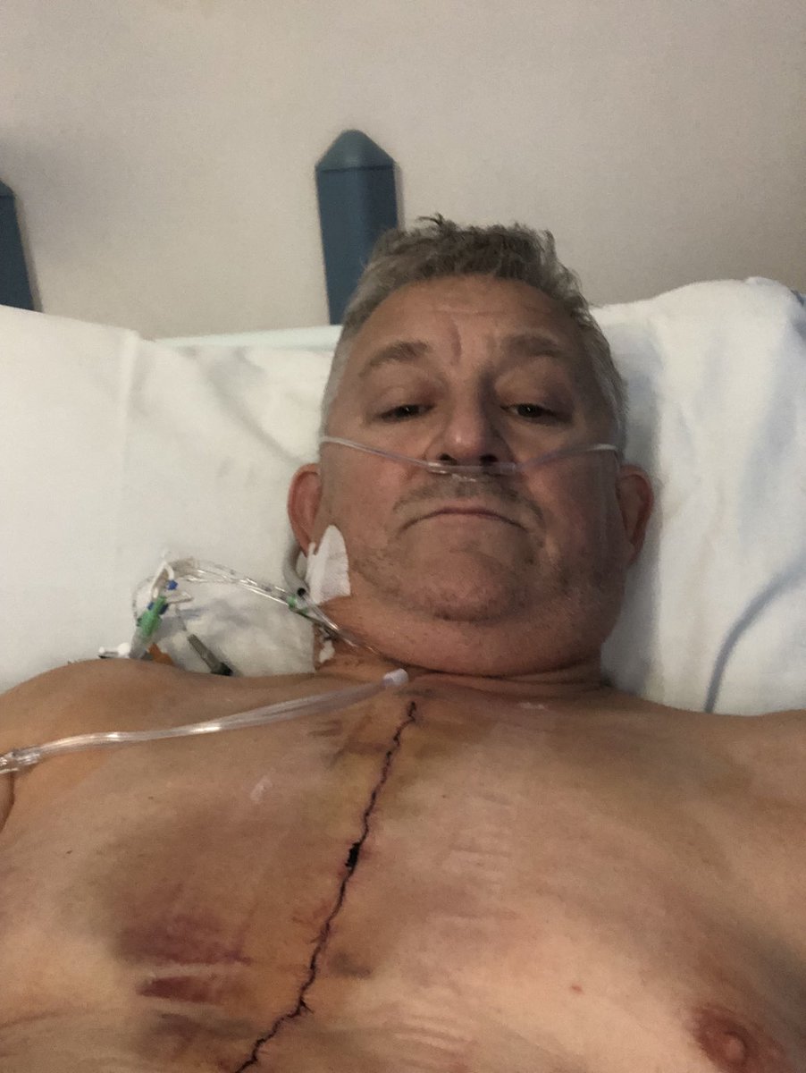 JS_KITCHENS_INT's tweet photo. Been 2 weeks since quadruple bypass surgery and home almost a week feeling much better, many thanks to all the staff at Hammersmith Hospital you are all amazing, all love to Jane you are being a super hero xxx https://t.co/LHykrqJ5pc