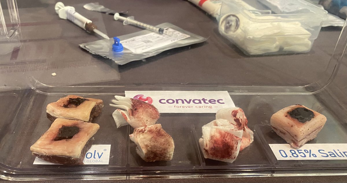 Learning so much at one of the ‘how to workshop’s’ exciting new debridement gel, ChloraSolv®, and impact in clinical practice.. lovely to catch up with @joytickle @ConvaTecWoundUK @Abbiemcloughli9 #woundsuk2022