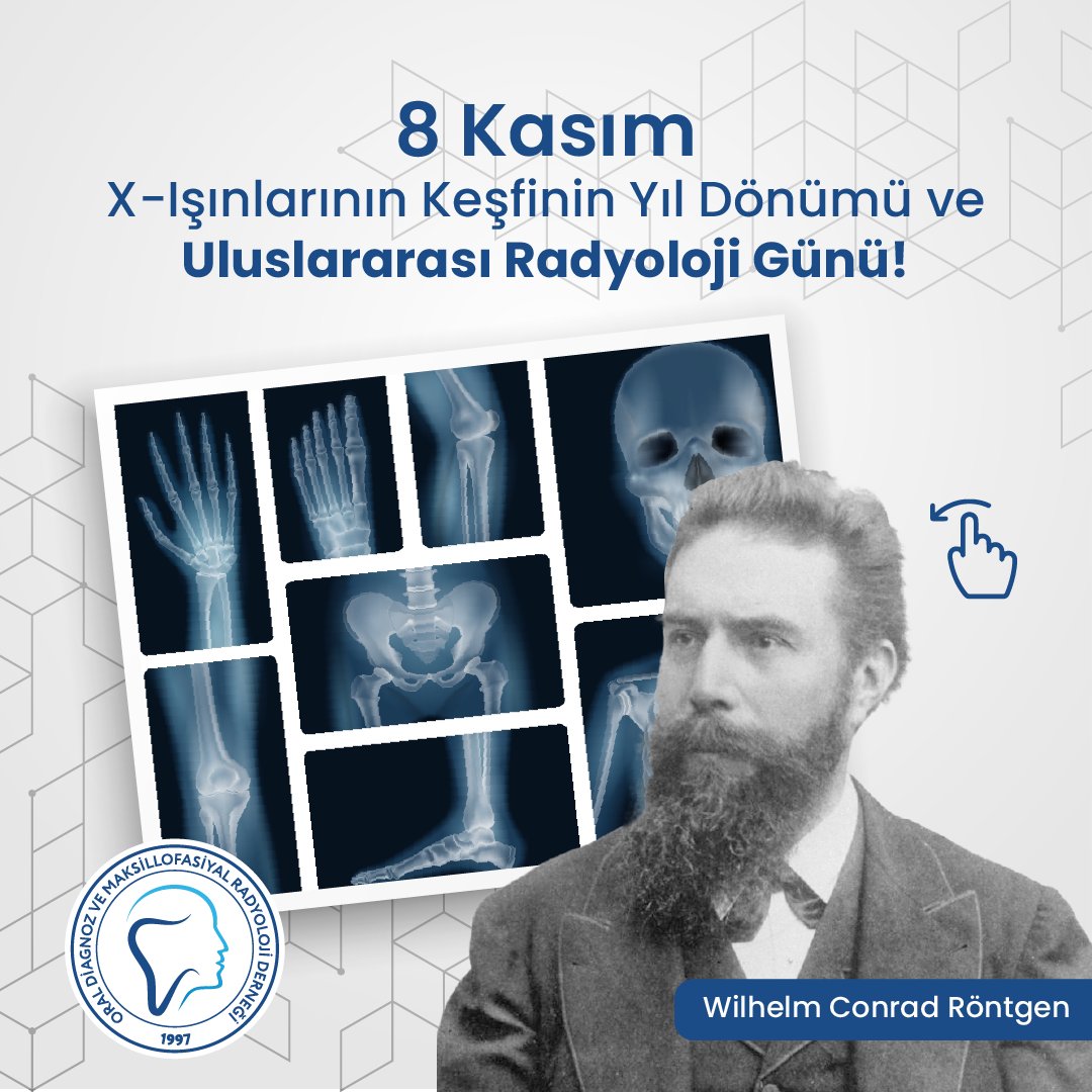 odmfr_der's tweet photo. Bugün Wilhelm Conrad Röntgen’in x-ışınlarını keşfetmesinin 127. yıl dönümü.
#odmfr #dişhekimliği #dişsağlığı #tomografi #bilgisayarlıtomografi #oralradyoloji #maksillofasiyalradyoloji #dentalradyoloji #başboyunradyolojisi #oraldiagnoz #dentistry #dişhekimi #dişsağlığı #xışını https://t.co/6uDXsiyusW