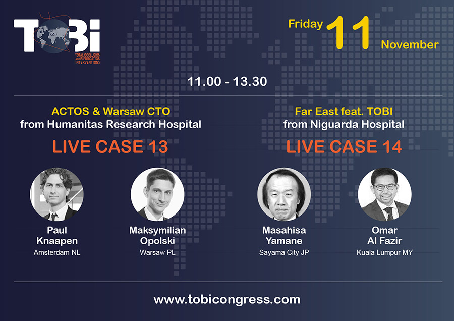 TOBI Total Occlusion Bifurcation Interventions (@tobicongress) on Twitter photo Live Case 13th and 14th on Friday 11th from Europe to Far East! #TOBI22
🎥Paul Knaapen <a href="/OpolskiMP/">Maksymilian Opolski</a>
🎥Yamane Omar Al Fazir
✏️tobicongress.com Live Case 13th and 14th on Friday 11th from Europe to Far East! #TOBI22
🎥Paul Knaapen <a href="/OpolskiMP/">Maksymilian Opolski</a>
🎥Yamane Omar Al Fazir
✏️tobicongress.com