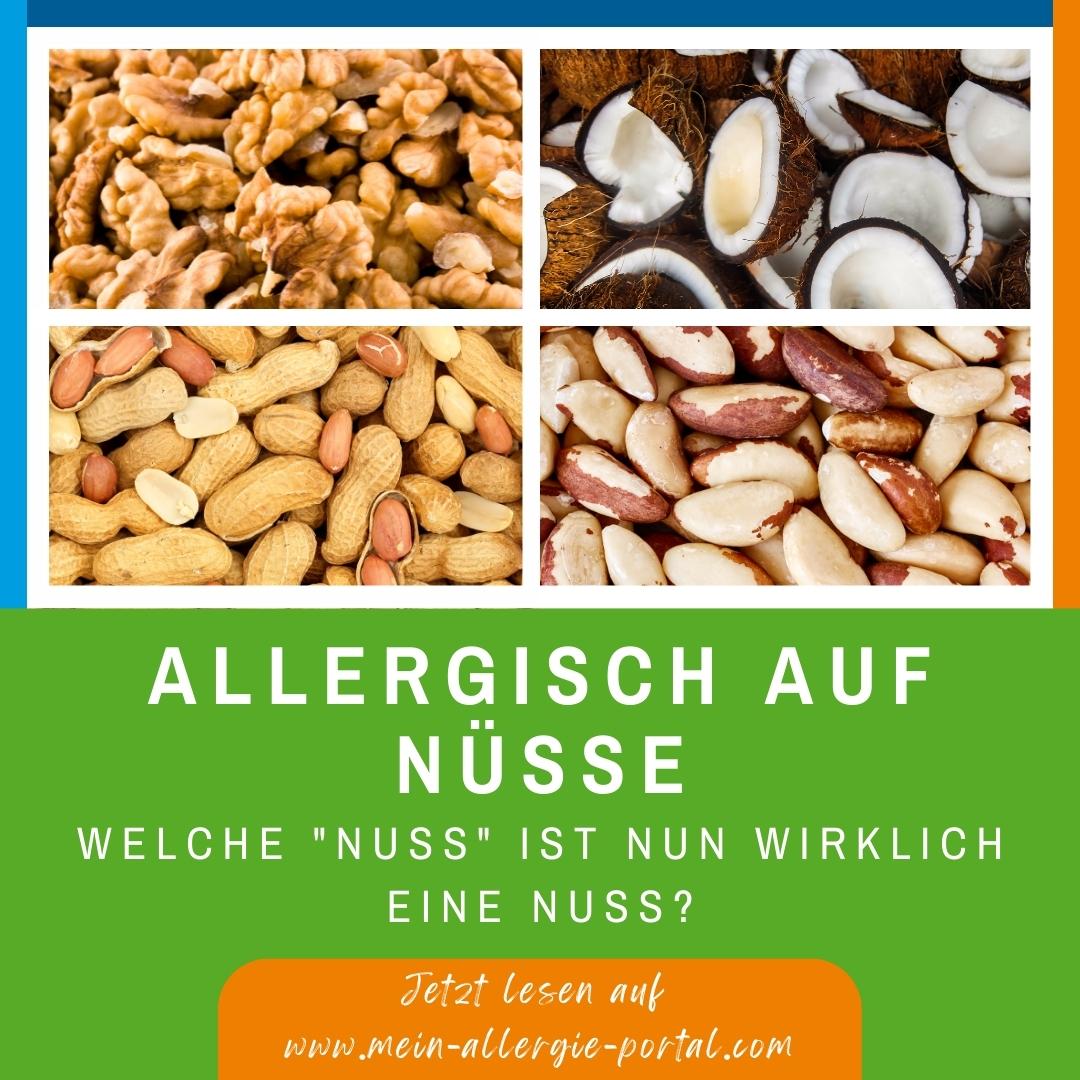 Wusstet ihr, dass die Erdnuss eigentlich keine „Nuss“, sondern viel eher eine Hülsenfrucht ist? Was ist überhaupt eine Nuss? Und was gibt es bei einer Nussallergie zu beachten? 
Mehr Infos im Interview!ℹ️bit.ly/3Eafsmv