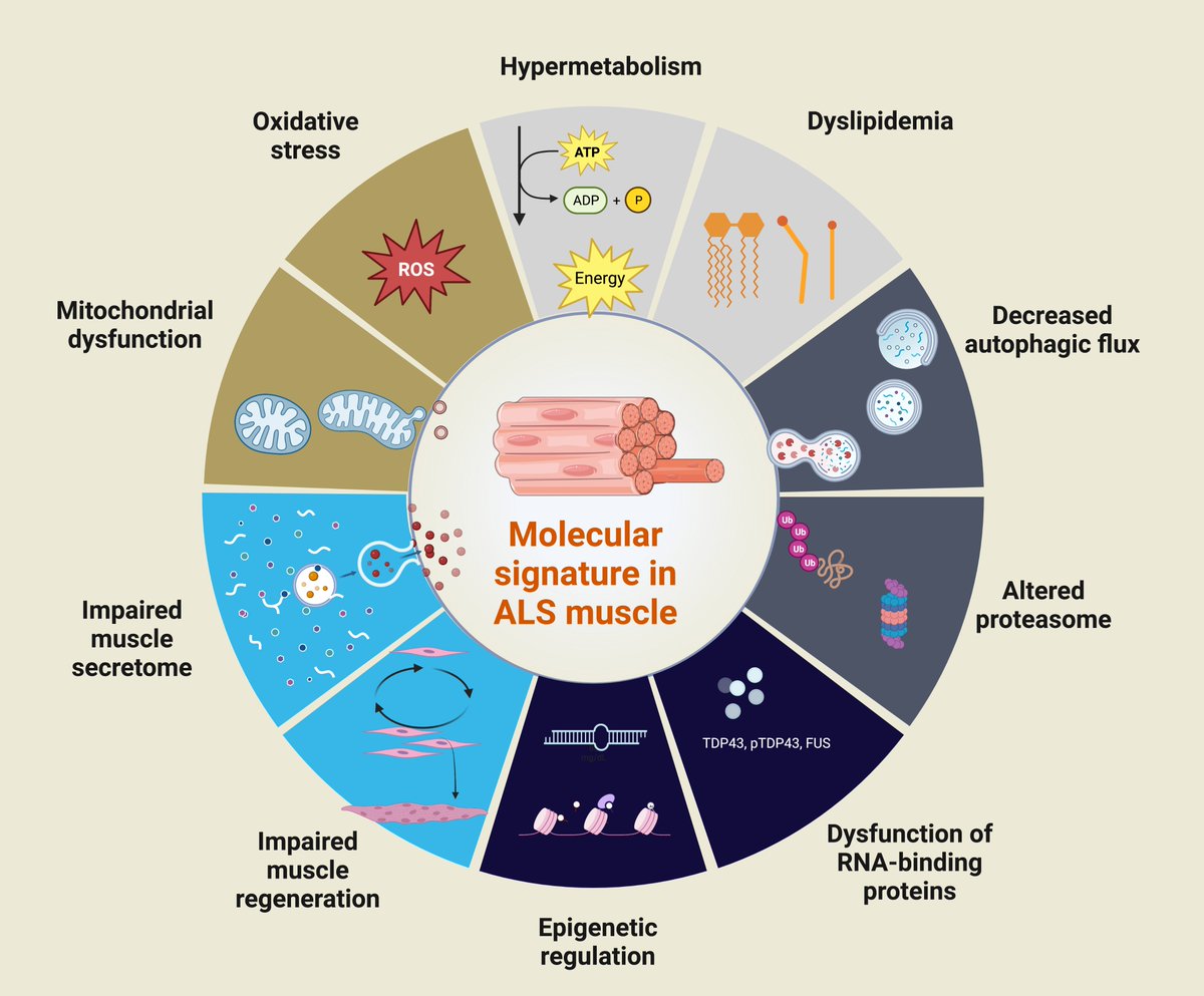 Stephanie Duguez (@sduguez_lab) on Twitter photo Congratulation <a href="/EkeneA28/">Ekene Anakor</a> for you review on "The Cellular and Molecular Signature of #ALS in Muscle" mdpi.com/1933682 #mdpijpm via <a href="/JPM_MDPI/">JPM_MDPI</a> #MND <a href="/proudofuu/">Pround Of You</a> <a href="/PersonalMedNI/">Personalised Medicine Centre</a> <a href="/UlsterUniMed/">School of Medicine | Ulster University</a> Congratulation <a href="/EkeneA28/">Ekene Anakor</a> for you review on "The Cellular and Molecular Signature of #ALS in Muscle" mdpi.com/1933682 #mdpijpm via <a href="/JPM_MDPI/">JPM_MDPI</a> #MND <a href="/proudofuu/">Pround Of You</a> <a href="/PersonalMedNI/">Personalised Medicine Centre</a> <a href="/UlsterUniMed/">School of Medicine | Ulster University</a>