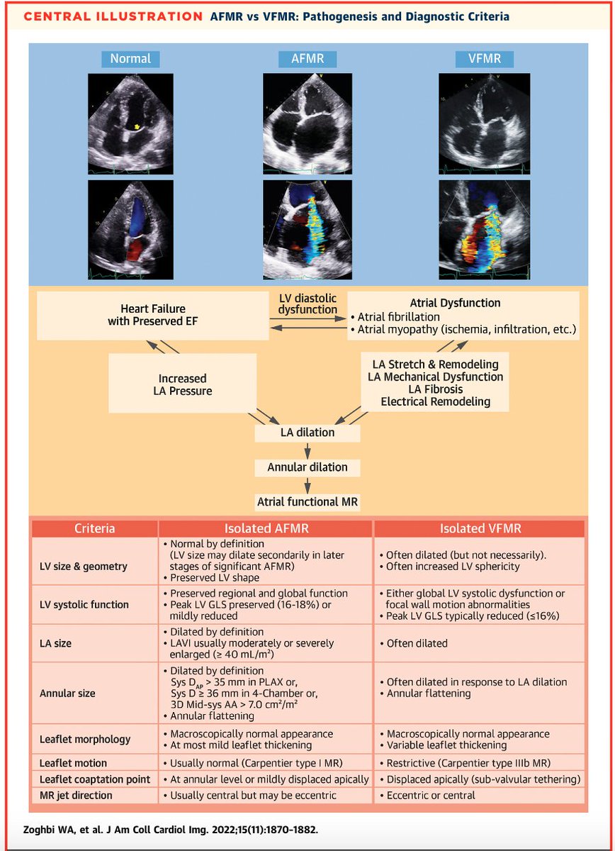 SeguraCardio's tweet photo. 📌Atrial Functional #Mitral Regurgitation: A @JACCJournals Cardiovascular Imaging #Viewpoint

#CardioTwitter #CardioEd #EchoFirst #WhyCMR #Mitraclip https://t.co/iBRgGmhrNM