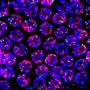 Diana Libuda (@dianalibuda) on Twitter photo Our latest paper is out in <a href="/PLOSGenetics/">PLOS Genetics</a>! It's about the effects of aging and sperm exposure on DNA break formation and repair in oocytes. Beautiful work by both grad student <a href="/EToraason/">Erik Toraason</a> and tech <a href="/VikkiLeeAdler/">VikkiLee</a>! ๐งฌ๐ฌ๐ชฑ#celegans #meiosis4eva journals.plos.org/plosgenetics/aโฆ Our latest paper is out in <a href="/PLOSGenetics/">PLOS Genetics</a>! It's about the effects of aging and sperm exposure on DNA break formation and repair in oocytes. Beautiful work by both grad student <a href="/EToraason/">Erik Toraason</a> and tech <a href="/VikkiLeeAdler/">VikkiLee</a>! ๐งฌ๐ฌ๐ชฑ#celegans #meiosis4eva journals.plos.org/plosgenetics/aโฆ