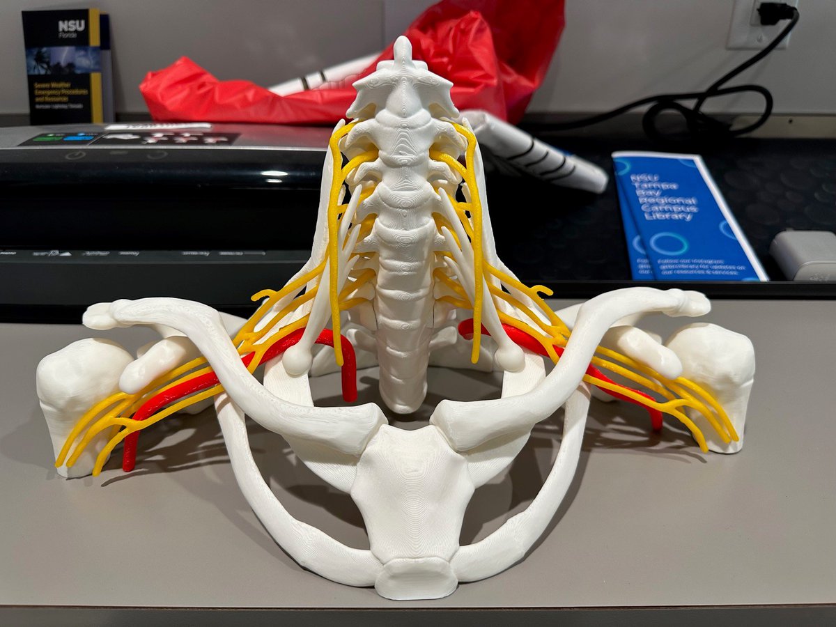 ezmuzic's tweet photo. Working on 3D printed models with university, #brachialplexus would make great teaching tools as they can be disassembled and reassembled, all parts are magnetic. https://t.co/4yjUj6B2tQ