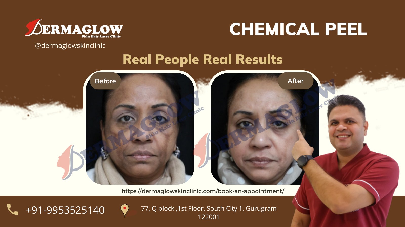 Dermaglow Skin Clinic Gurgaon Dr. Santpal (SangwanSantpal) / Twitter