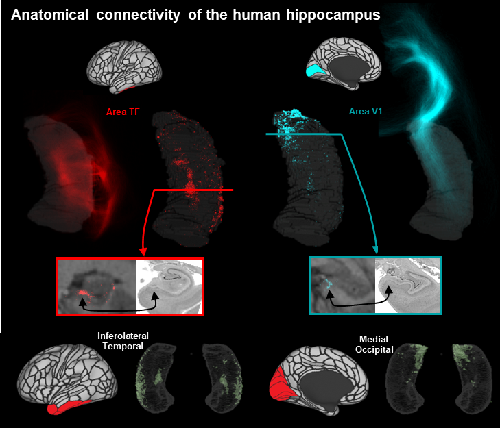 fercalamante's tweet photo. Very pleased to see this long project led by Marshall Dalton in eLife (https://t.co/8BCH83ju7q). Lots of follow up work happening now, which we can't wait to share soon. Thanks also for related eLife "Insight article" by Bryan Strange @The_Strange_Lab (https://t.co/73l2FkLIuw) https://t.co/xWdigXQQQJ