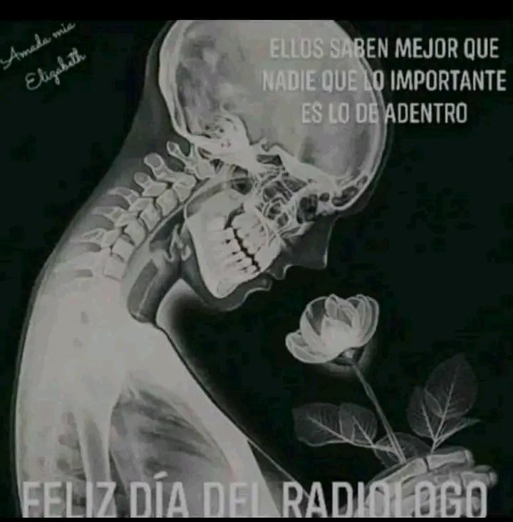 Felicitaciones a todos los radiologos en su día 
#Cubacooperabolivar2 
#CubaPorLaSalud 
<a href="/cdilamanga/">CDI Villa La Manga</a> 
<a href="/CandidoReyesMa4/">Dr.Candido Reyes Martinez</a> 
<a href="/YuslemisG/">Yuslemis González</a> 
<a href="/MaridolisH/">Maridolis Delgado Hernández</a> 
<a href="/LopezYudisley/">yudisley lopez alonso</a> 
<a href="/AdanVillavicen5/">Adan Villavicencio Guzmán</a>