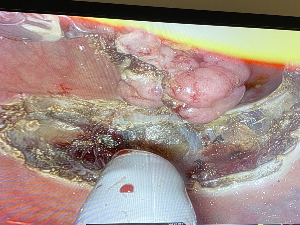 Great job @SureshYelika and @NickAhn