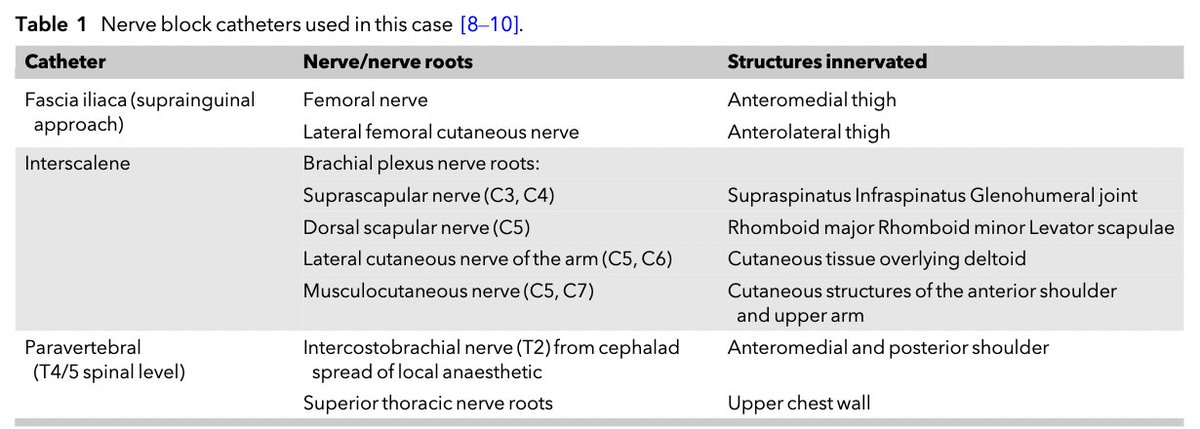 Anaes_Reports's tweet photo. Do you ever use more than one peripheral nerve catheter at a time?

How about THREE?!

@womackjonathan @SpruceyLu et al used fascia iliaca, interscalene &amp; paravertebral catheters for a right extended scapulectomy, humeral suspension &amp;  thigh free-flap.

https://t.co/oVTcY88D1i https://t.co/xtVePx4mIN